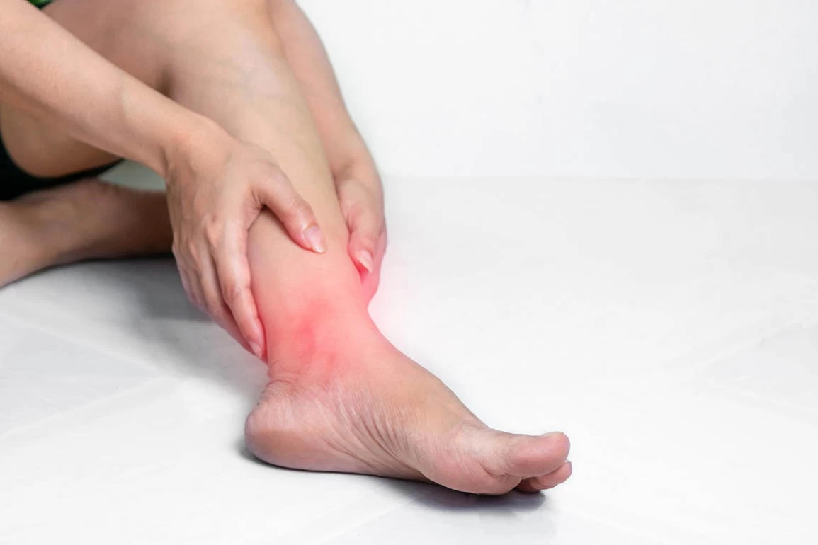 پیچ خوردگی مچ پا نوع High ankle sprain یا آسیب سیندسموزیس