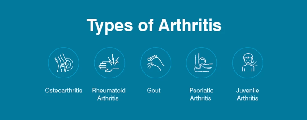 آشنایی با انواع بیماری آرتریت و روش‌های درمان آن
