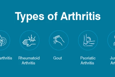 آشنایی با انواع بیماری آرتریت و روش‌های درمان آن