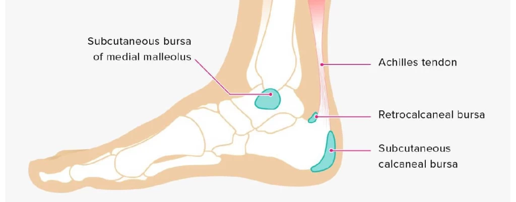 التهاب بورس پاشنه پا: علل، علائم و راه‌های درمان