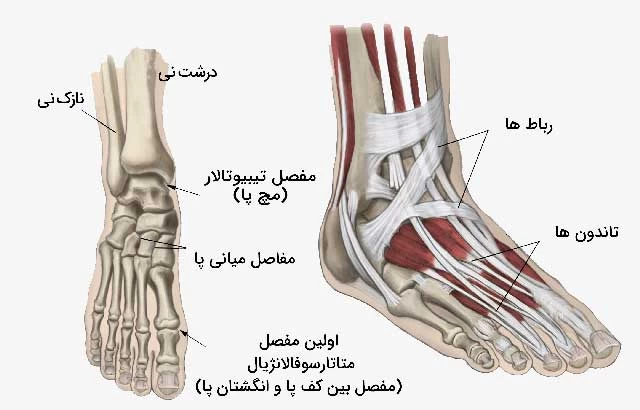 آرتریت پا و مچ پا؛ دلایل، علائم، و بهترین روش‌های درمان