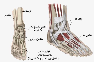 آرتریت پا و مچ پا؛ دلایل، علائم، و بهترین روش‌های درمان