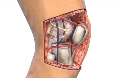 علت قفل شدن زانو و روش‌های درمان آن