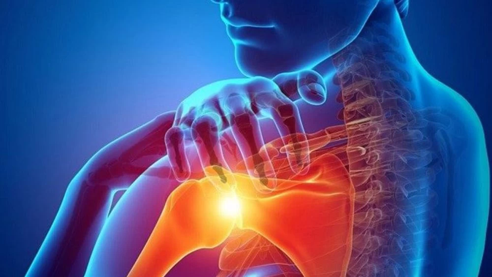 توانبخشی پس از جراحی تعویض مفصل شانه: بازگشت به زندگی فعال