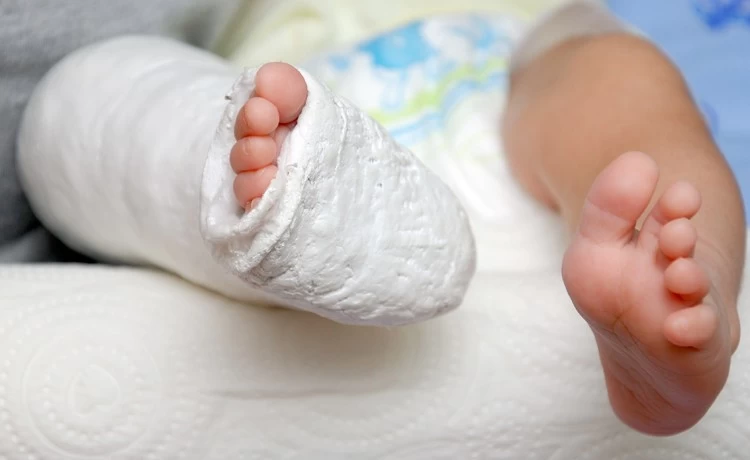 جراحی ارتوپدی در کودکان: چالش‌ها و راهکارهای درمانی