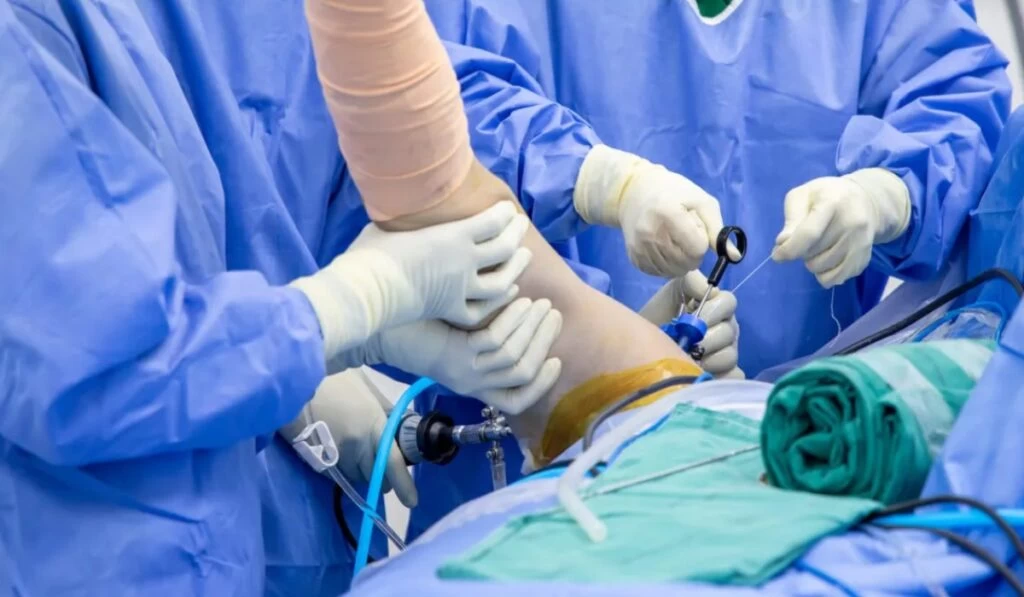 جدیدترین روش‌های جراحی تاندون برای بازگشت به فعالیت‌های ورزشی