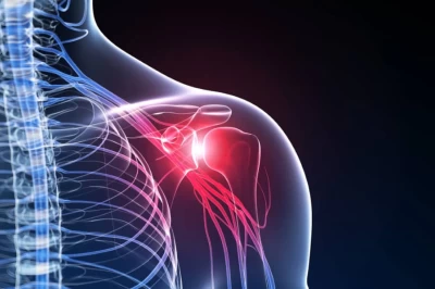 جراحی ترمیمی شانه: بازسازی روتاتور کاف و درمان دررفتگی‌های مکرر