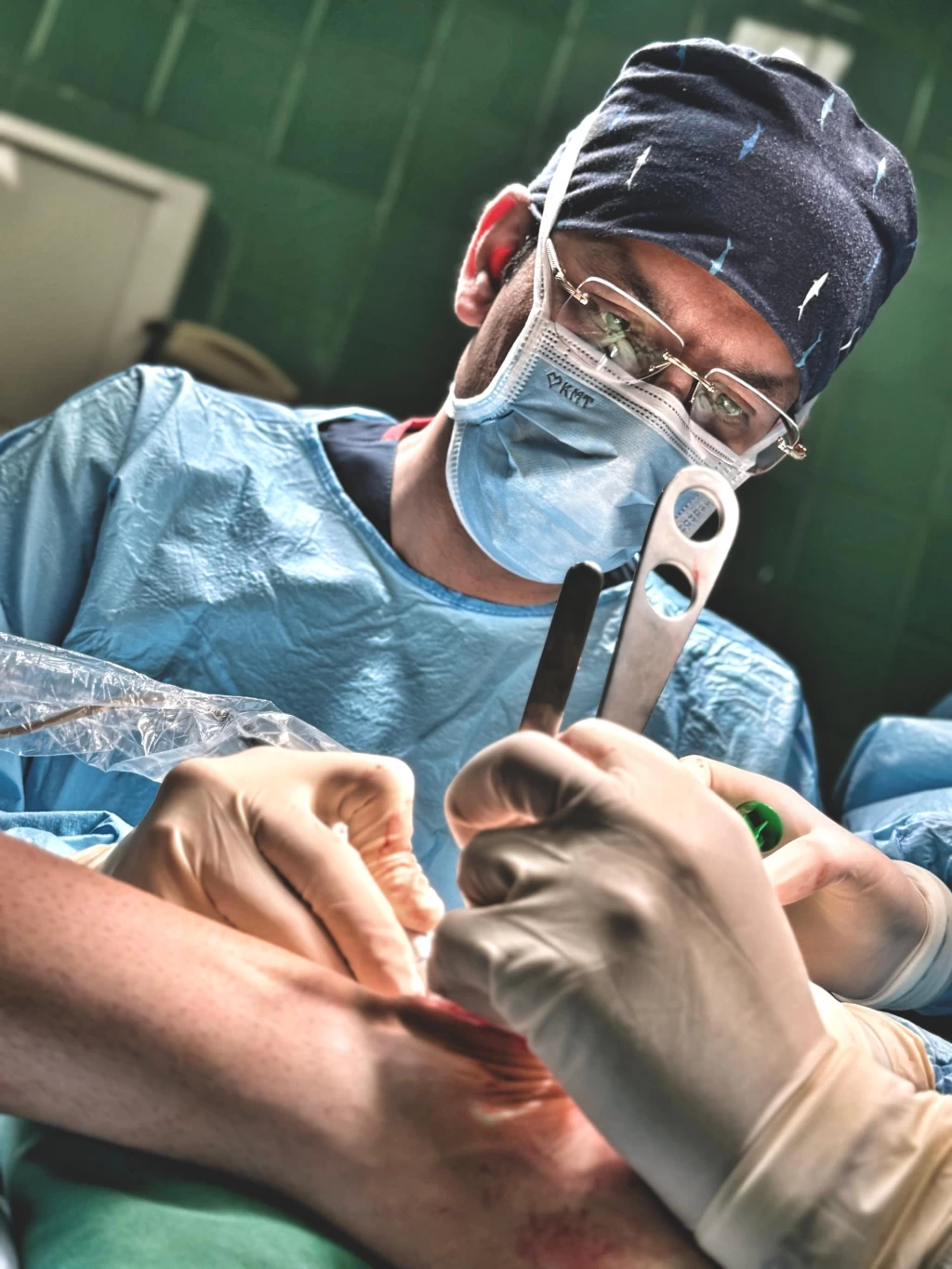 شکستگی پا | علائم هشداردهنده، روش تشخیص و جدیدترین درمان‌ها