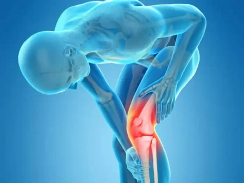 آرتروپلاستی زانو در بیماران جوان: مزایا و محدودیت‌ها | بررسی علمی عملکرد مفصل و کیفیت زندگی
