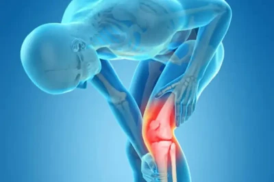 آرتروپلاستی زانو در بیماران جوان: مزایا و محدودیت‌ها | بررسی علمی عملکرد مفصل و کیفیت زندگی
