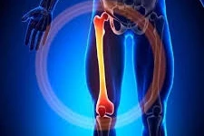 ارتباط درد زانو با ناهنجاری‌های لگن و مچ پا | بررسی تأثیر محورهای حرکتی