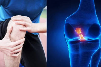 بررسی ارتباط بین ضعف همسترینگ و آسیب ACL | نقش عضلات پشت ران در پایداری زانو
