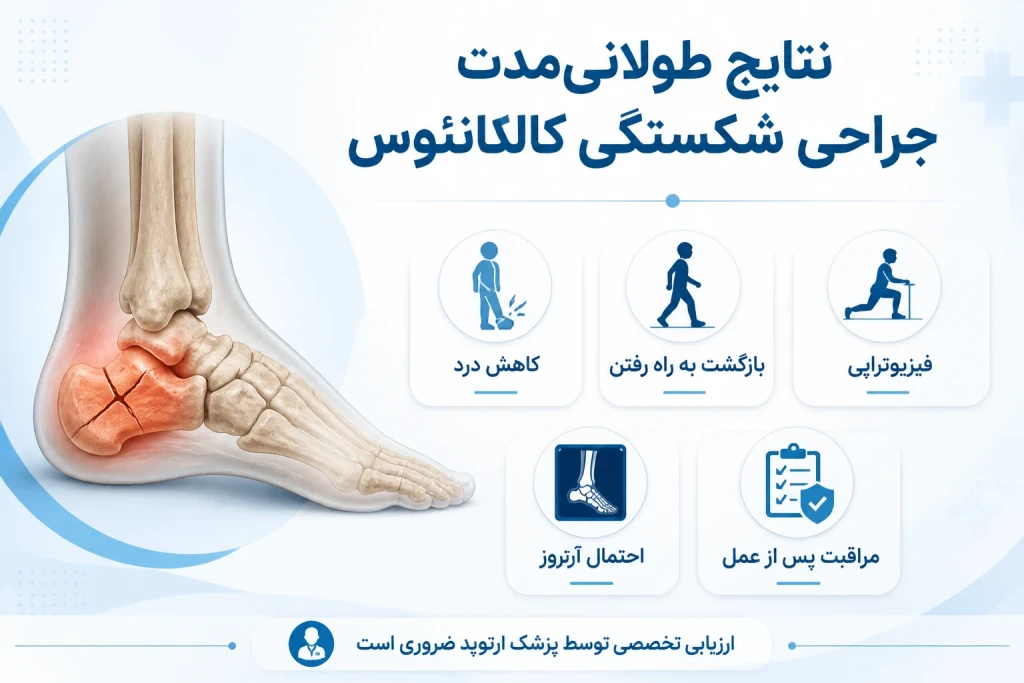 نتایج طولانی‌مدت جراحی شکستگی کالکانئوس | بررسی پیامدهای درمانی در آسیب پاشنه پا