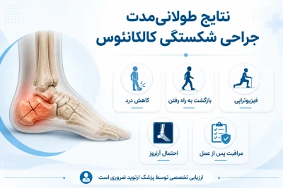 نتایج طولانی‌مدت جراحی شکستگی کالکانئوس | بررسی پیامدهای درمانی در آسیب پاشنه پا
