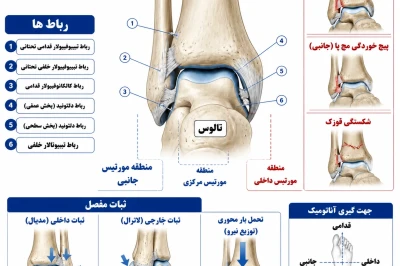 مورتیس یا مفصل مچ پا: ثبات و آسیب‌های مرتبط