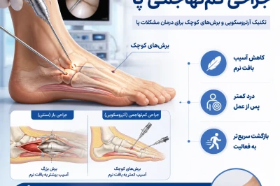 تکنیک‌های کم‌تهاجم در جراحی پا | تحولی نوین در درمان آسیب‌های مچ و کف پا