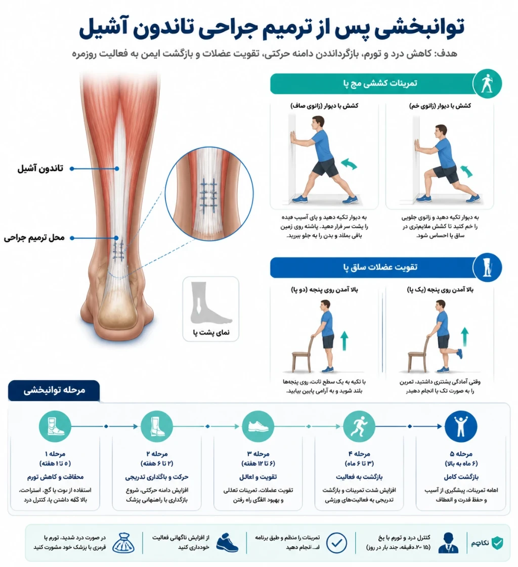 راهنمای جامع توانبخشی پس از ترمیم تاندون آشیل | بازگشت هوشمندانه به فعالیت ورزشی