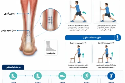 راهنمای جامع توانبخشی پس از ترمیم تاندون آشیل | بازگشت هوشمندانه به فعالیت ورزشی