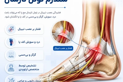 سندرم تونل تارسال: علائم، تشخیص و جراحی | بررسی فشار عصب مچ پا