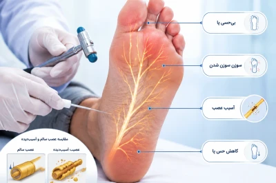 نوروپاتی محیطی پا در بیماران دیابتی | بررسی علائم، تشخیص و روش‌های درمان