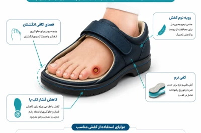 انتخاب کفش مناسب برای بیماران مبتلا به زخم پا