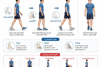 ارزیابی راه رفتن در بیماران پس از آسیب پا | بررسی الگوی gait و روند بهبود