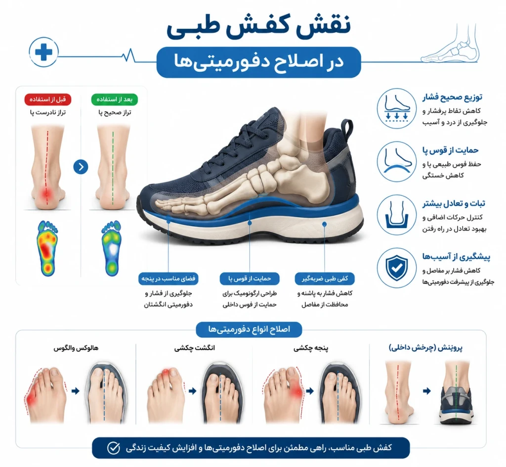 نقش کفش طبی در اصلاح دفورمیتی‌ها | بررسی علمی تأثیر کفش‌های طبی در سلامت پا