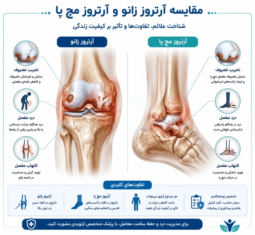 تفاوت آرتروز مچ پا با زانو | بررسی تفاوت‌های پاتوفیزیولوژی و درمان