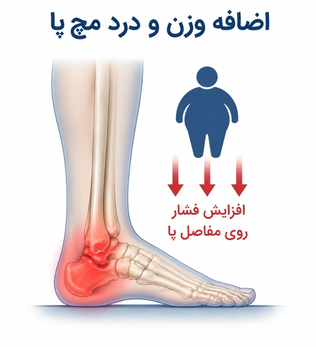 بررسی اثر وزن بالا بر دردهای پا و مچ پا