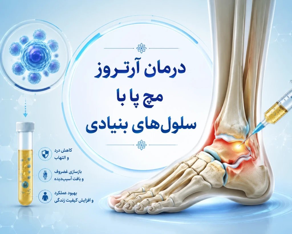استفاده از سلول‌های بنیادی در درمان آرتروز مچ پا | روش نوین بازسازی مفصل و کاهش درد