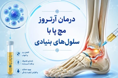استفاده از سلول‌های بنیادی در درمان آرتروز مچ پا | روش نوین بازسازی مفصل و کاهش درد