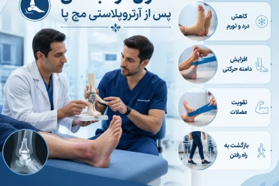اصول توانبخشی پس از آرتروپلاستی مچ پا