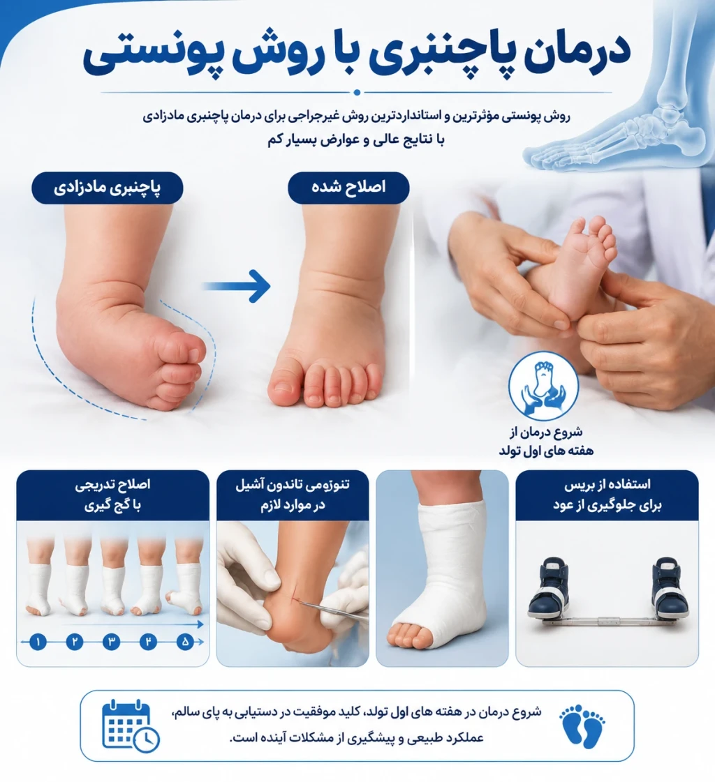 درمان پاچنبری (Clubfoot) با روش پونستی | اصلاح ناهنجاری مادرزادی پا