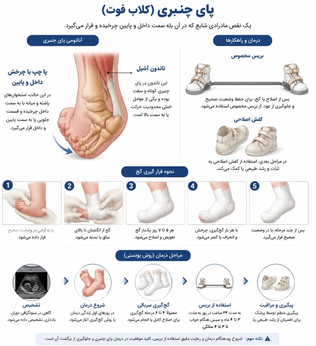 پیگیری طولانی‌مدت بیماران مبتلا به کلاب فوت | اهمیت درمان مداوم و اصلاح پای چنبری