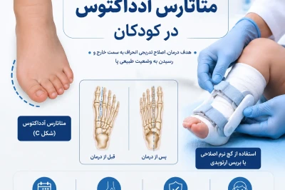 درمان دفورمیتی متاتارس آدداکتوس در کودکان | بررسی روش‌های اصلاح ناهنجاری پنجه پا