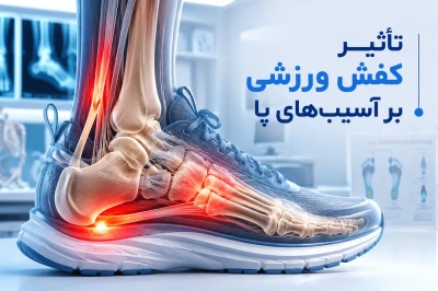 تأثیر کفش ورزشی بر آسیب‌های پا در دوندگان