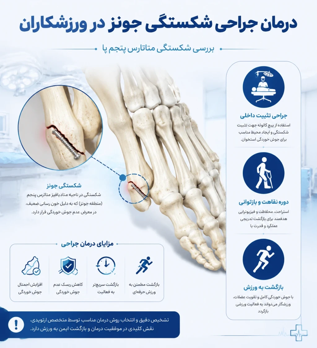 درمان جراحی شکستگی جونز در ورزشکاران | بررسی روش‌های نوین درمانی شکستگی متاتارس پنجم