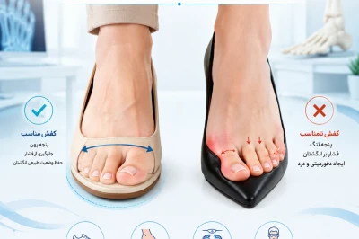 راهکارهای پیشگیری از دفورمیتی انگشتان در خانم‌ها | بررسی علل تغییر شکل انگشتان پا