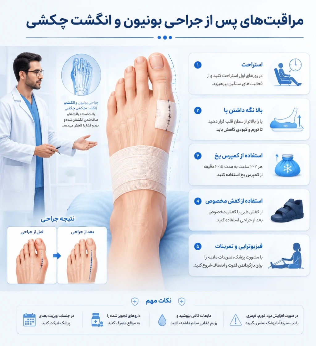 مراقبت‌های پس از جراحی بونیون و انگشت چکشی | راهنمای کامل دوران بهبودی پا