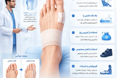 مراقبت‌های پس از جراحی بونیون و انگشت چکشی | راهنمای کامل دوران بهبودی پا