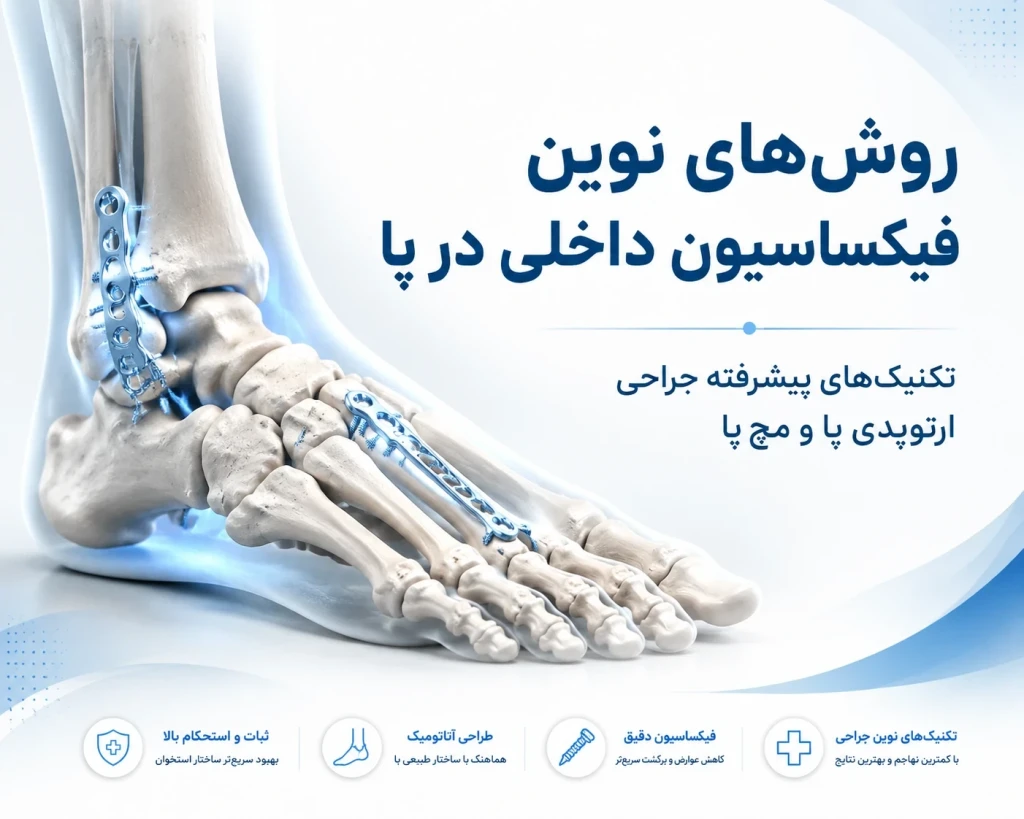روش‌های نوین فیکساسیون داخلی در پا | بررسی تکنیک‌های پیشرفته جراحی ارتوپدی پا