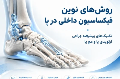 روش‌های نوین فیکساسیون داخلی در پا | بررسی تکنیک‌های پیشرفته جراحی ارتوپدی پا