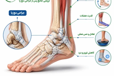 ارزیابی بازگشت به ورزش پس از جراحی مچ پا | معیارهای آمادگی، زمان‌بندی و کاهش ریسک آسیب مجدد