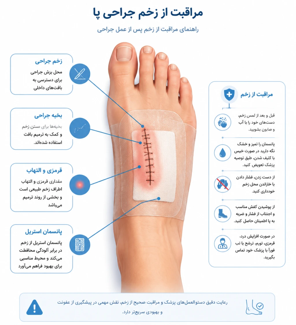 اصول مراقبت از زخم‌های جراحی پا| راهنمای جامع پیشگیری از عفونت