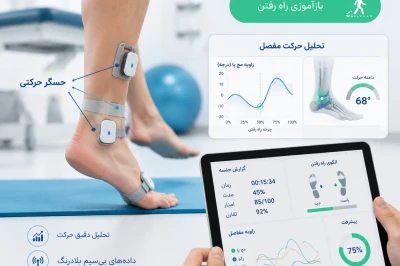 استفاده از حسگرهای حرکتی در توانبخشی پا