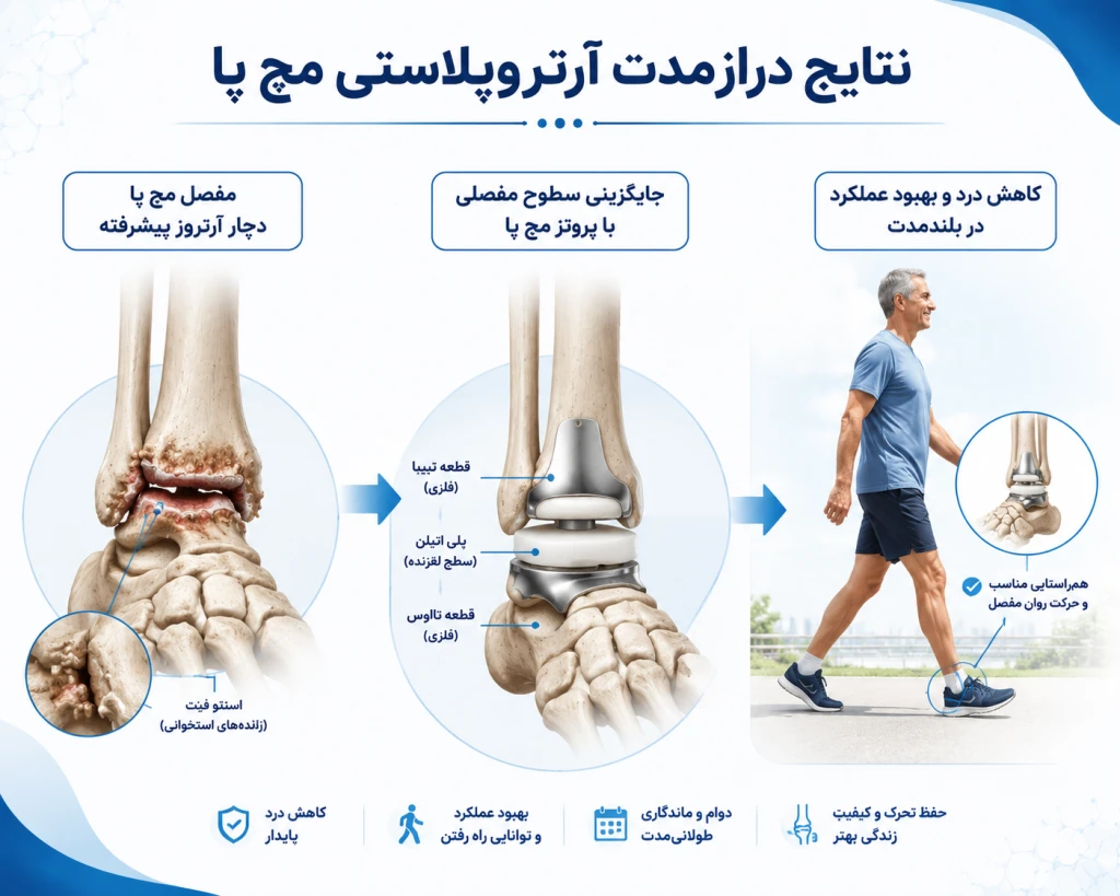 بررسی نتایج درازمدت آرتروپلاستی مچ پا
