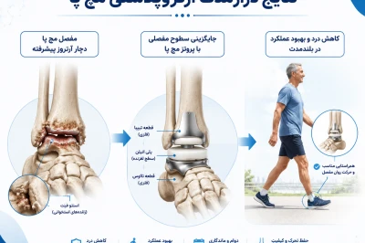 بررسی نتایج درازمدت آرتروپلاستی مچ پا