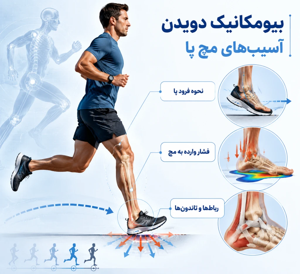 بیومکانیک دویدن و تأثیر آن بر آسیب‌های مچ پا | بررسی علمی فشارهای وارده در ورزشکاران