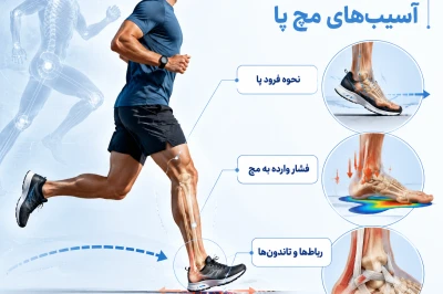 بیومکانیک دویدن و تأثیر آن بر آسیب‌های مچ پا | بررسی علمی فشارهای وارده در ورزشکاران