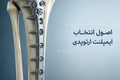 اصول انتخاب ایمپلنت مناسب در جراحی ارتوپدی | راهنمای علمی انتخاب ایمپلنت‌های ارتوپدی